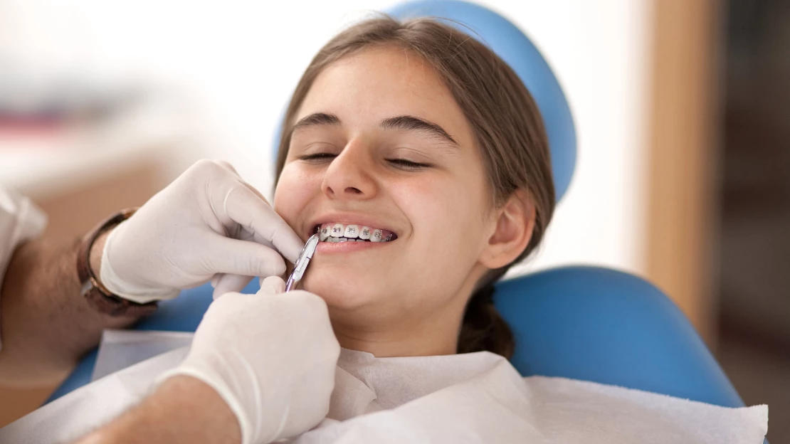 SEO Blog Orthodontics to fix Overbite.png